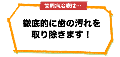 歯周病の治療は…徹底的に歯の汚れを取り除きます！